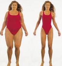example of dramatic weight loss