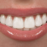 smile