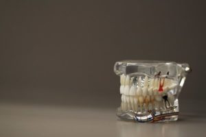 dental model