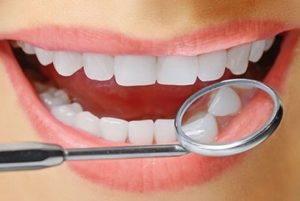White Teeth